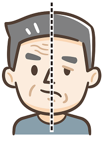 Bell's Palsy Physiotherapy