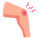 Physiotherapy For MCL/LCL Sprain Link